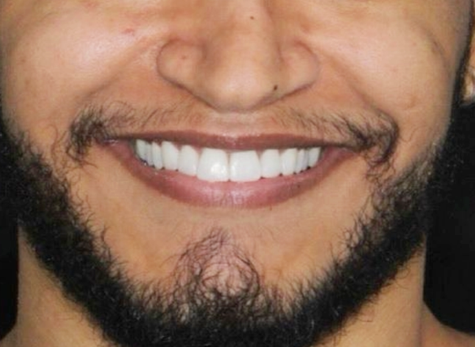 Odontologia Estética